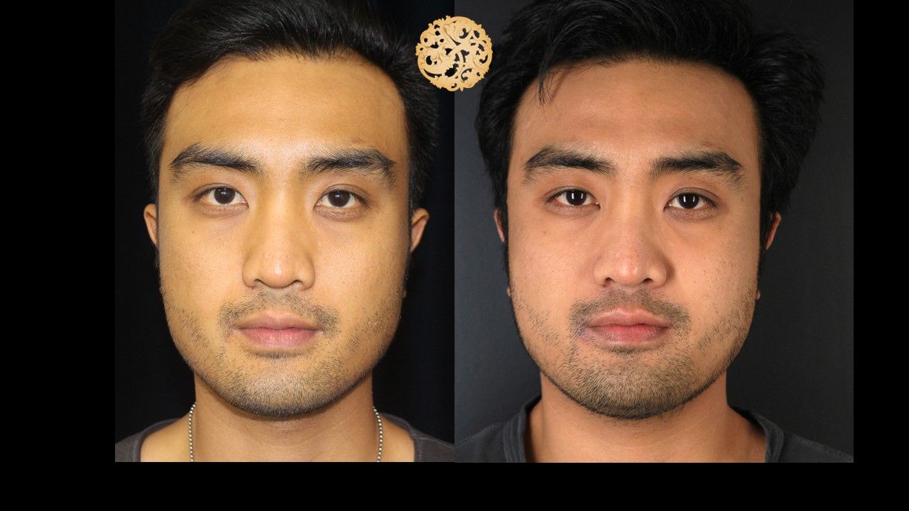 Vivace Before & After