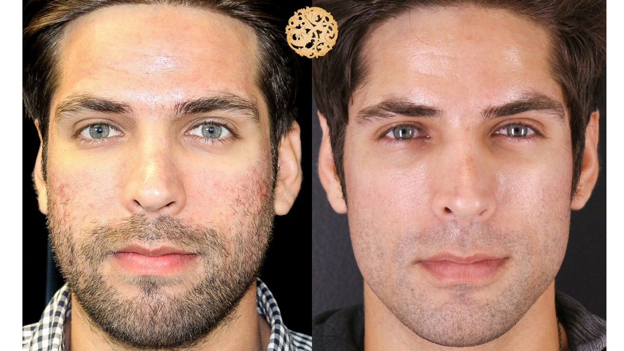 Vivace Before & After