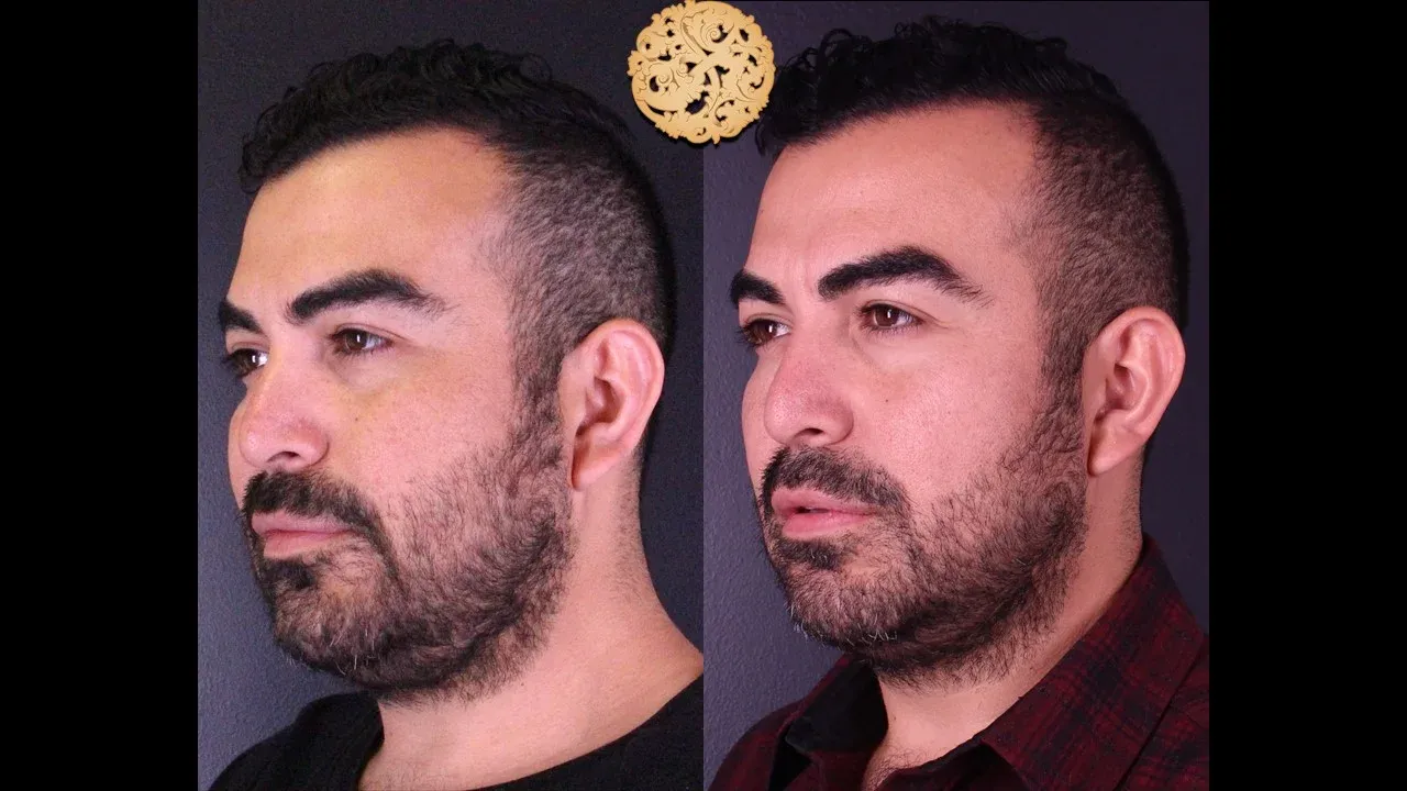 Vivace Before & After