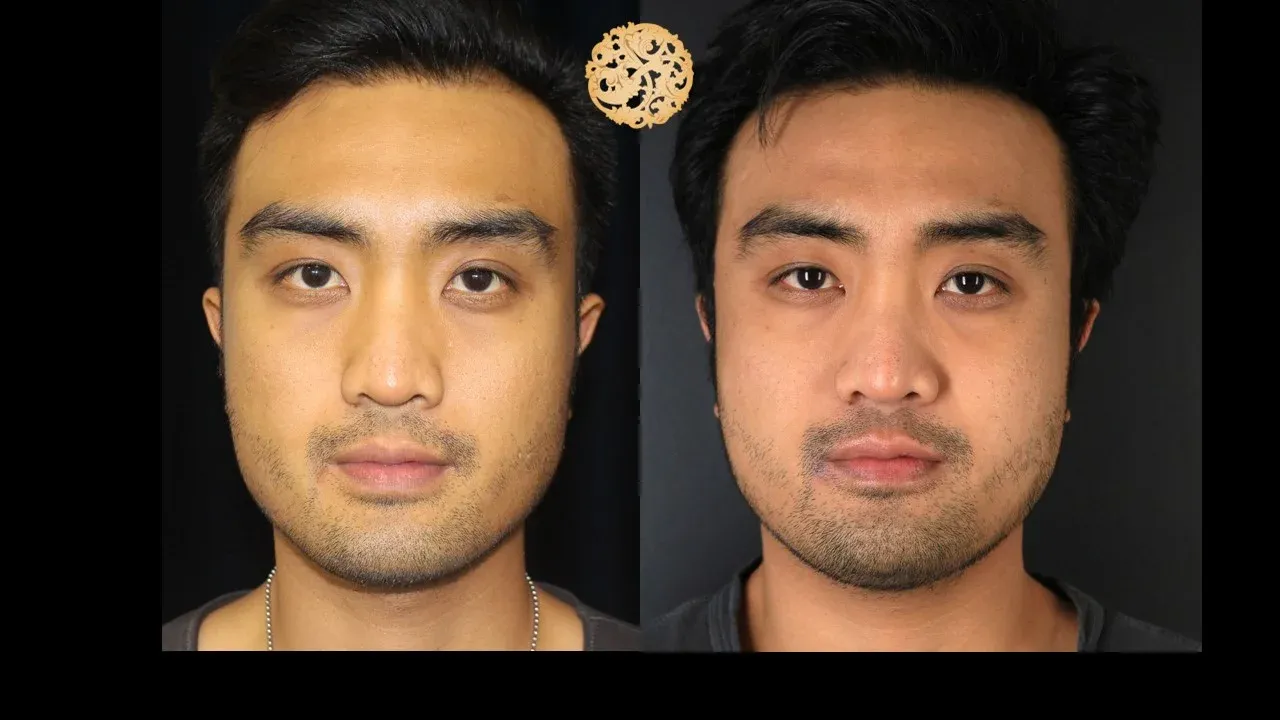 Vivace Before & After