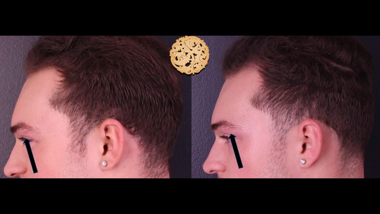 Excel V Before & After