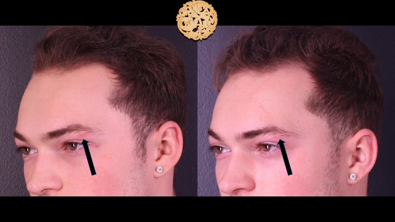 Excel V Before & After