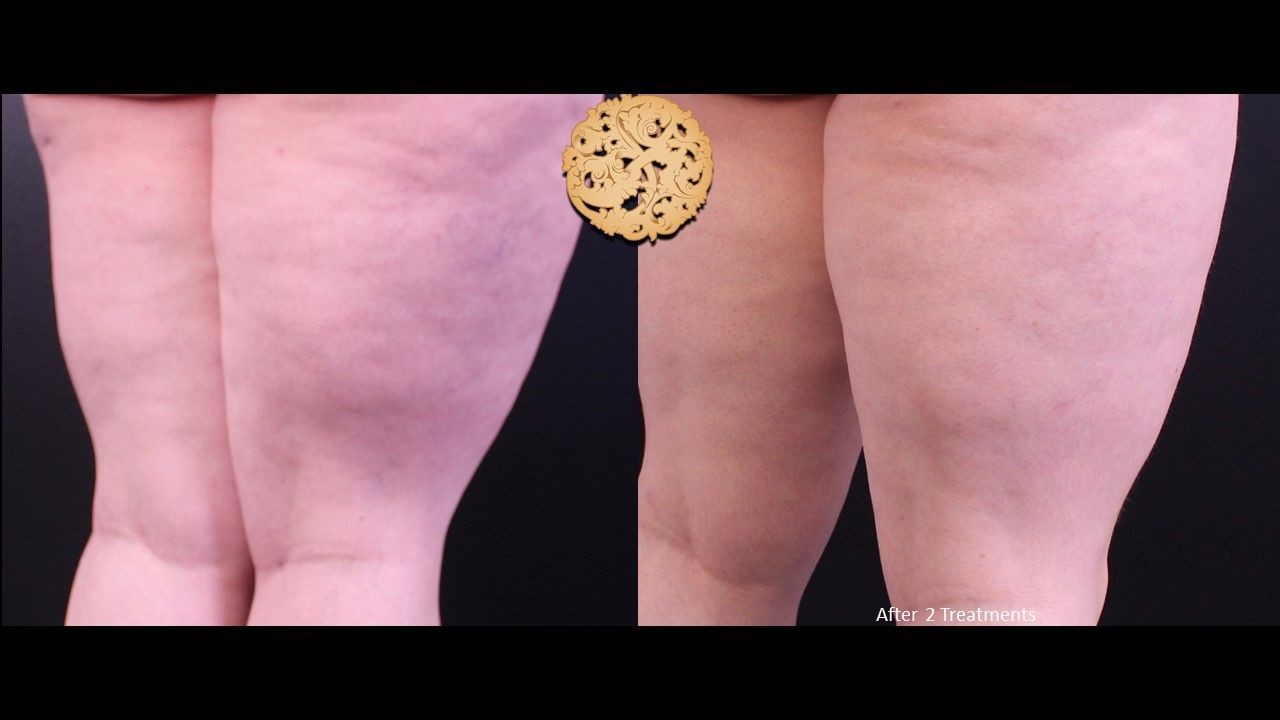 Excel V Before & After