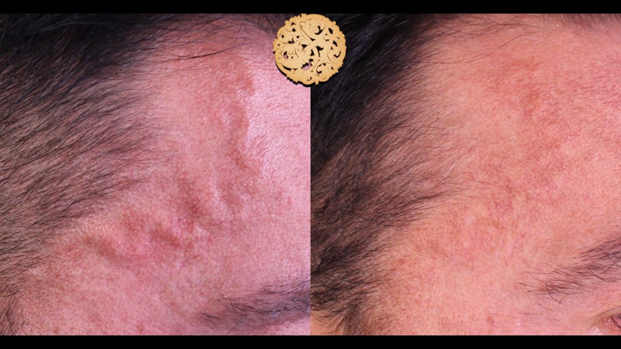 Excel V Before & After