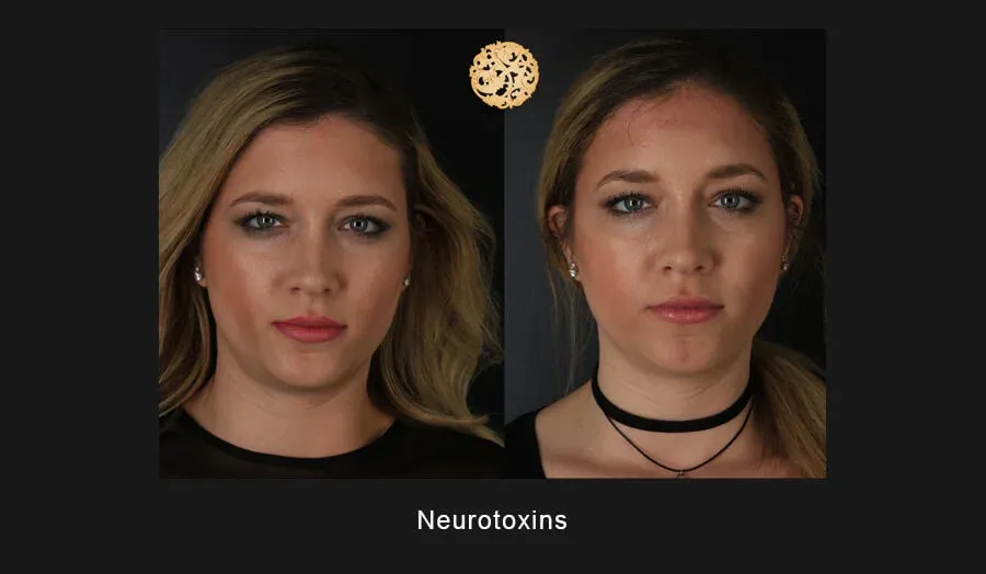 Neurotoxins Before & After