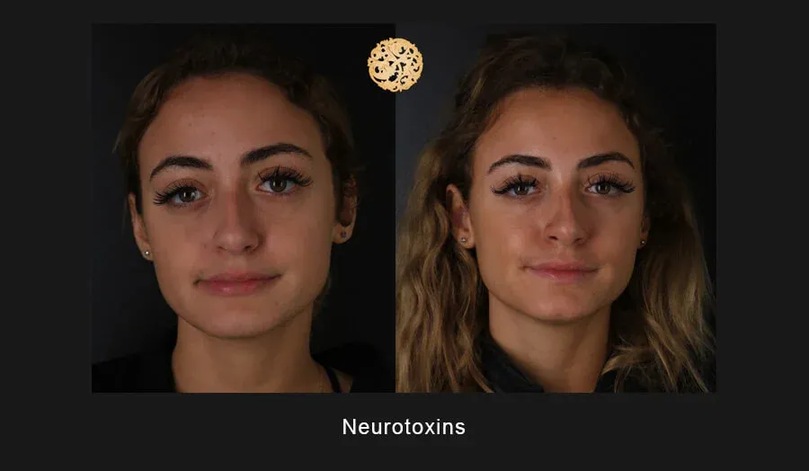 Neurotoxins Before & After