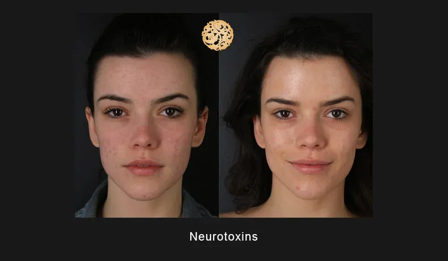 Neurotoxins Before & After