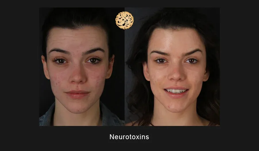 Neurotoxins Before & After