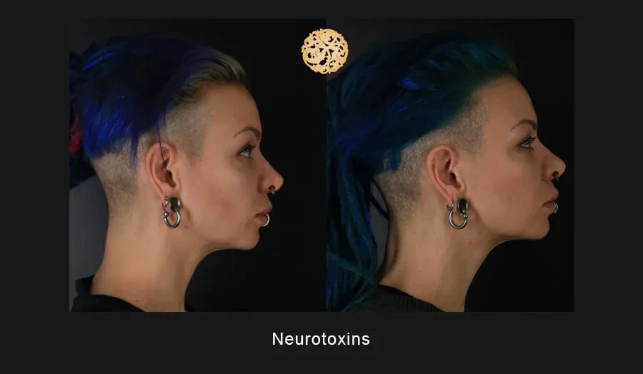 Neurotoxins Before & After