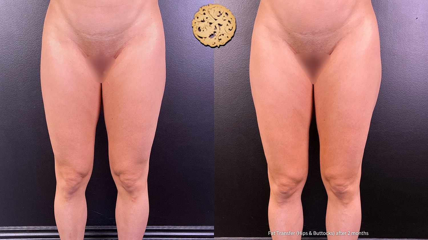 Before & After