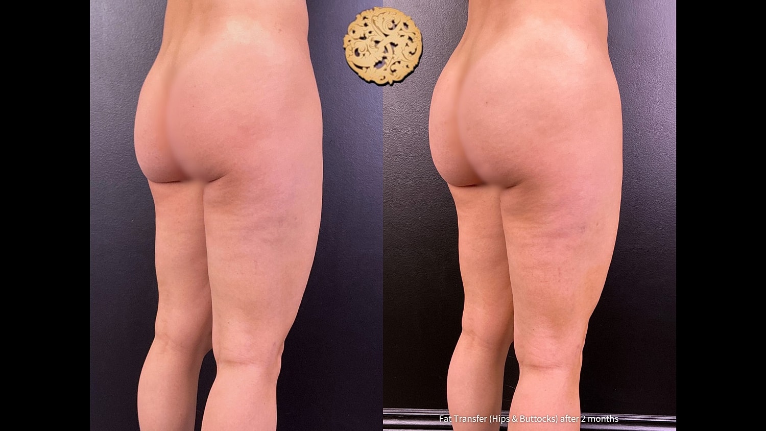 Before & After