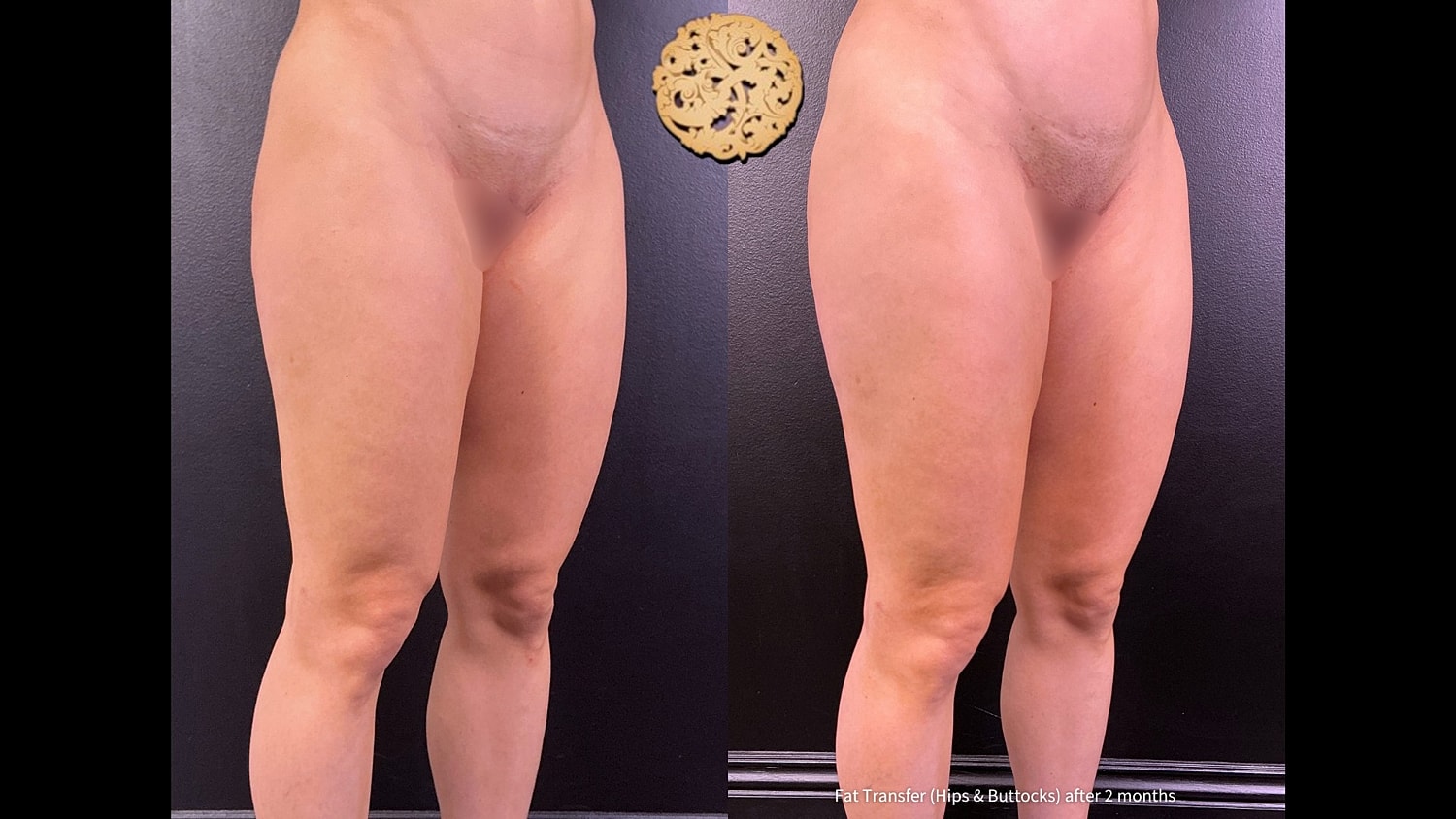 Before & After