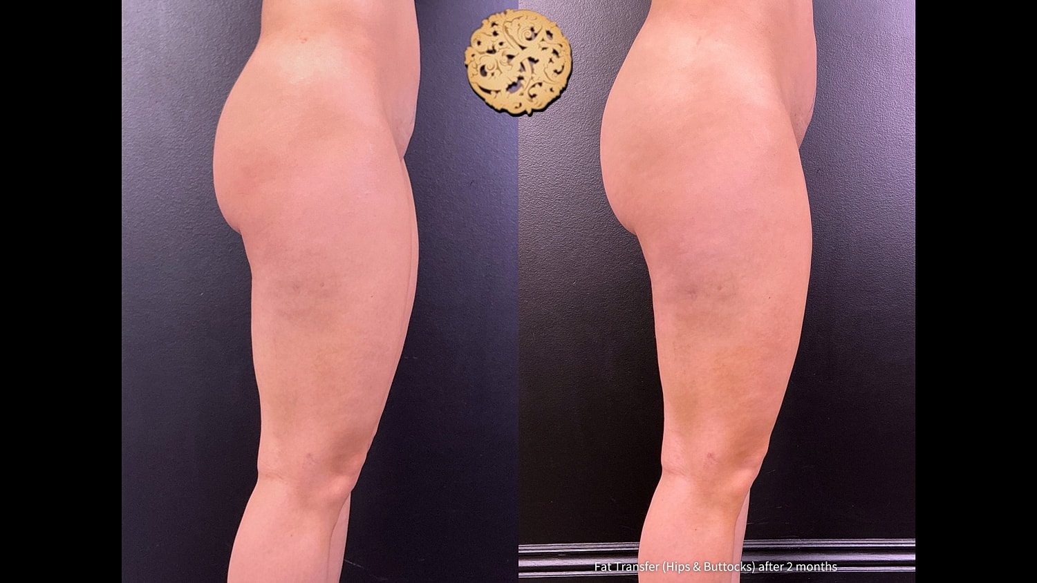Before & After