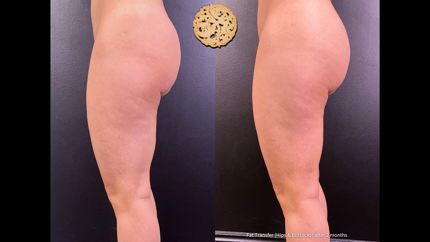 Before & After