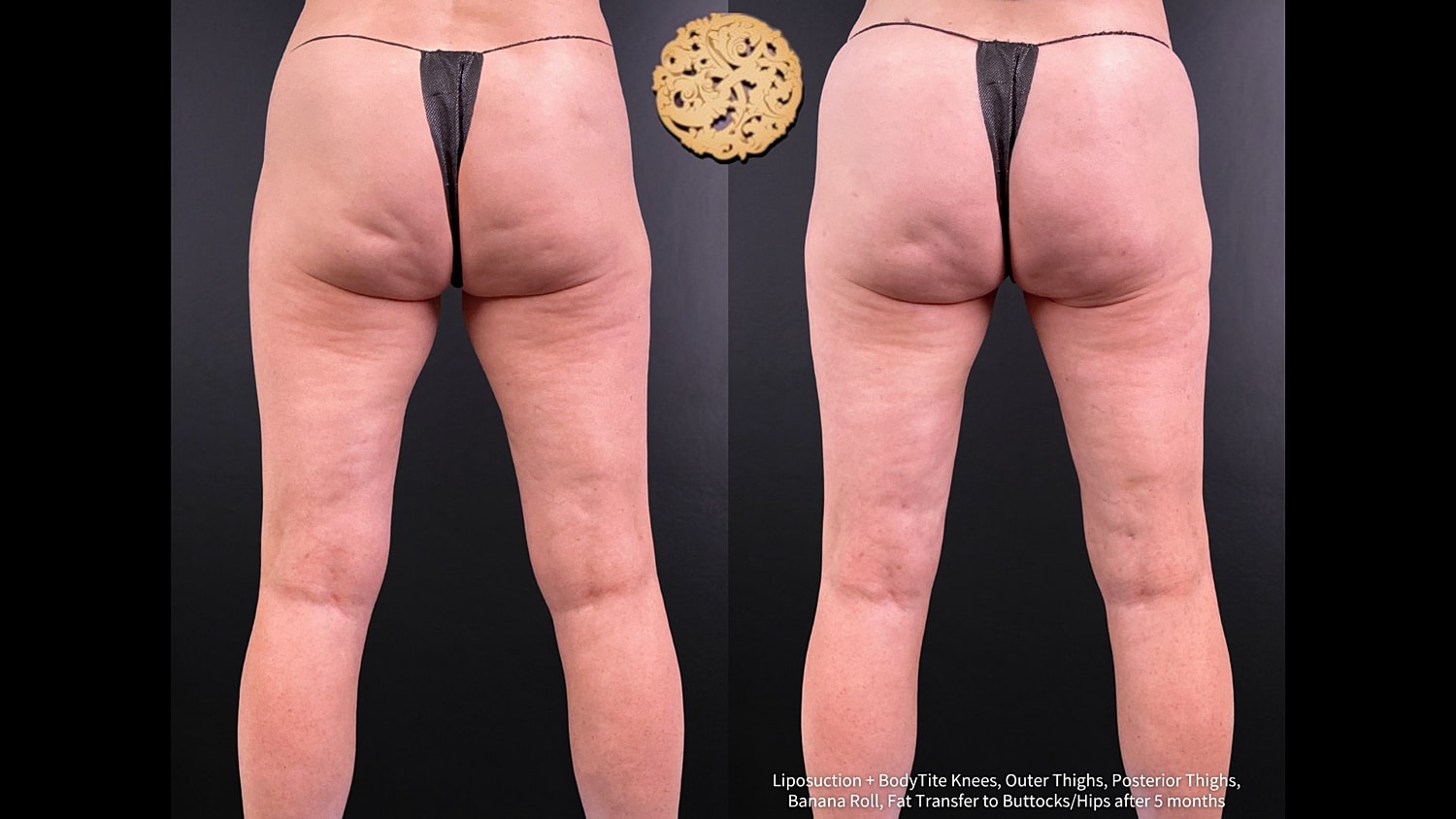 Before & After