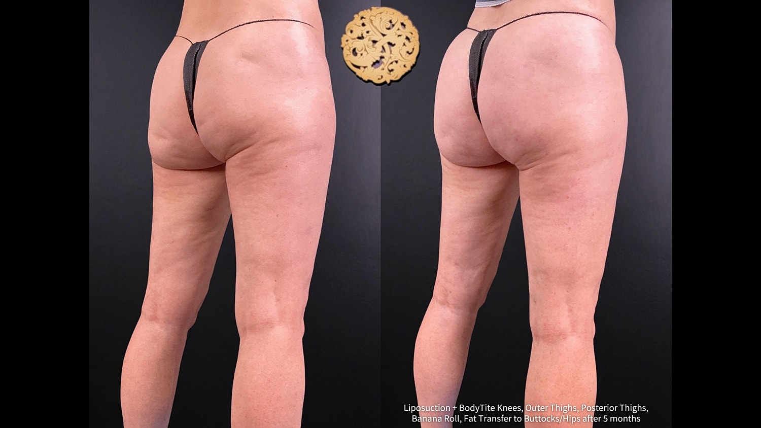 Before & After