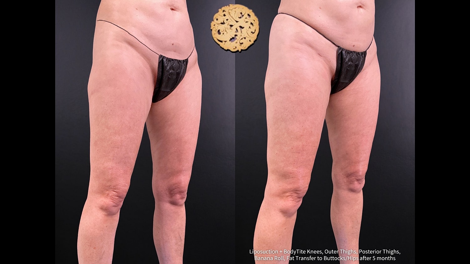 Before & After