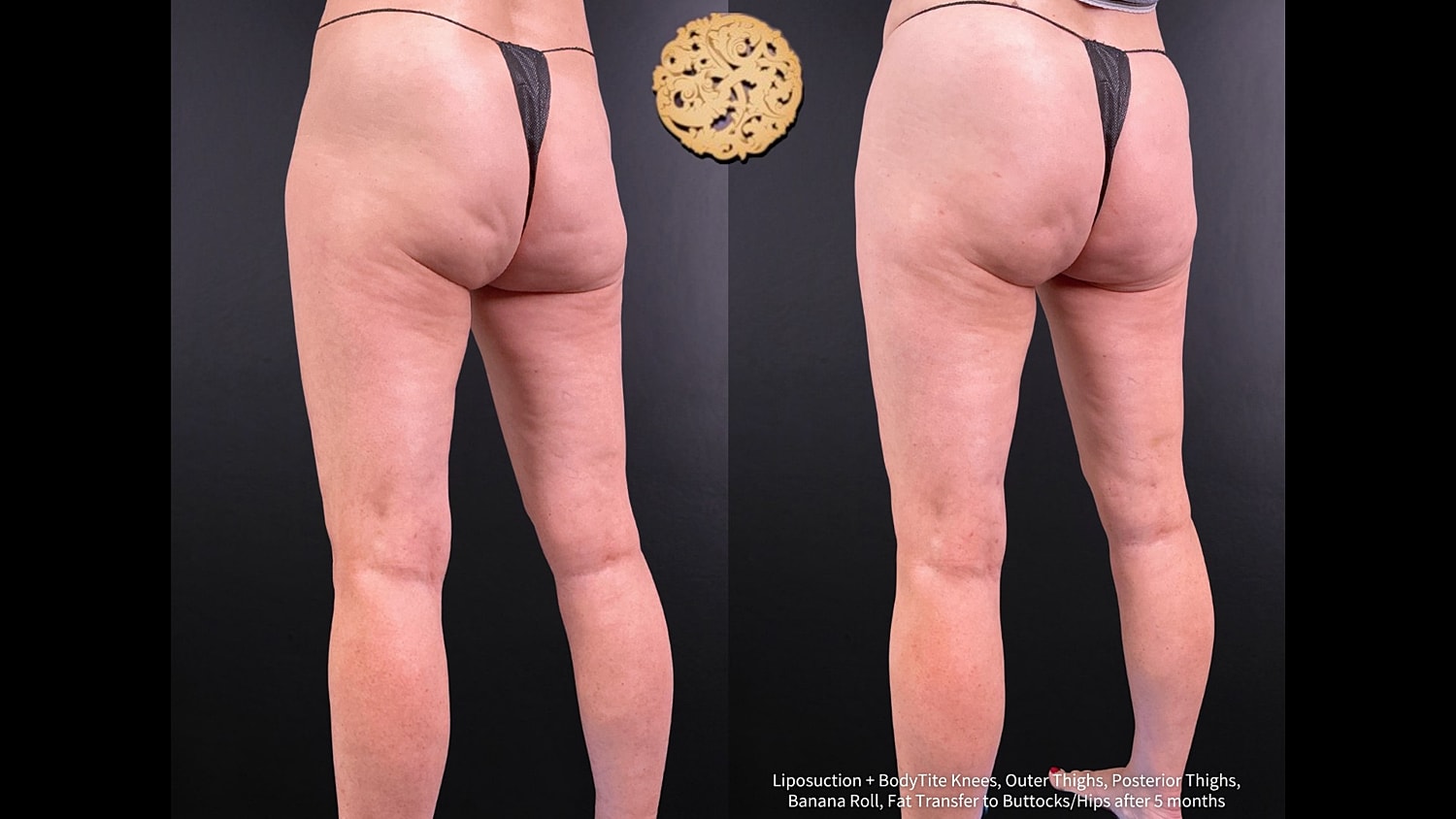 Before & After