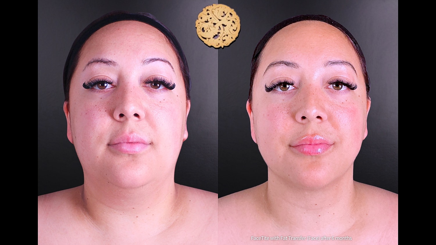 Before & After