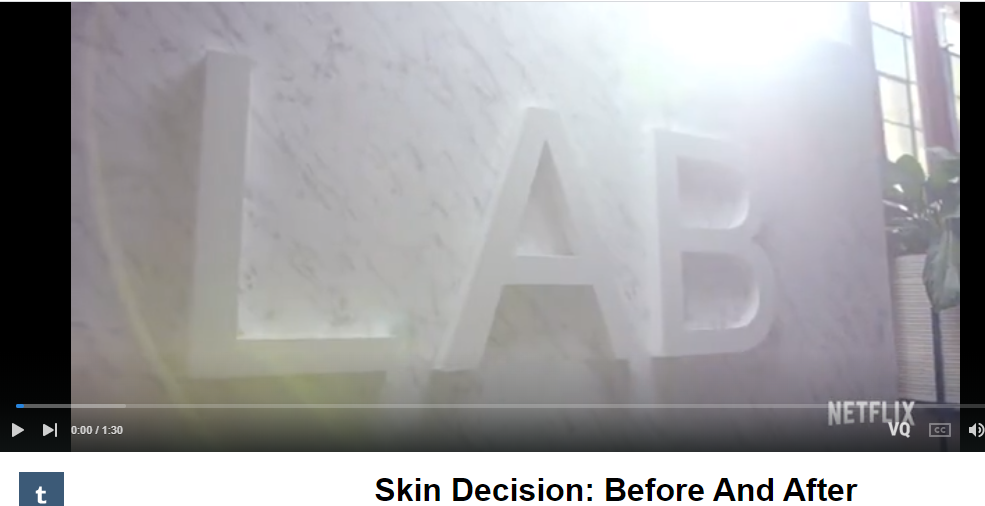 Skin Decision: Before And After