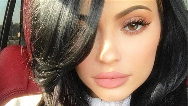 Kylie Jenner: Will She Have To Skip Lip Injections During Pregnancy?