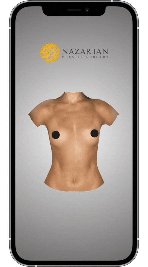 3D Imaging Breast Augmentation Consultation Nazarian Plastic Surgery