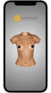 Advanced 3D Visualization For Breast Augmentation Beverly Hills Consultation